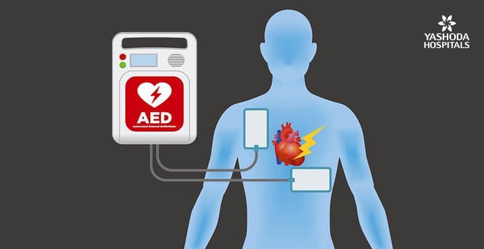 Atrial Fibrillation – Keeping the heart’s electrical system in order