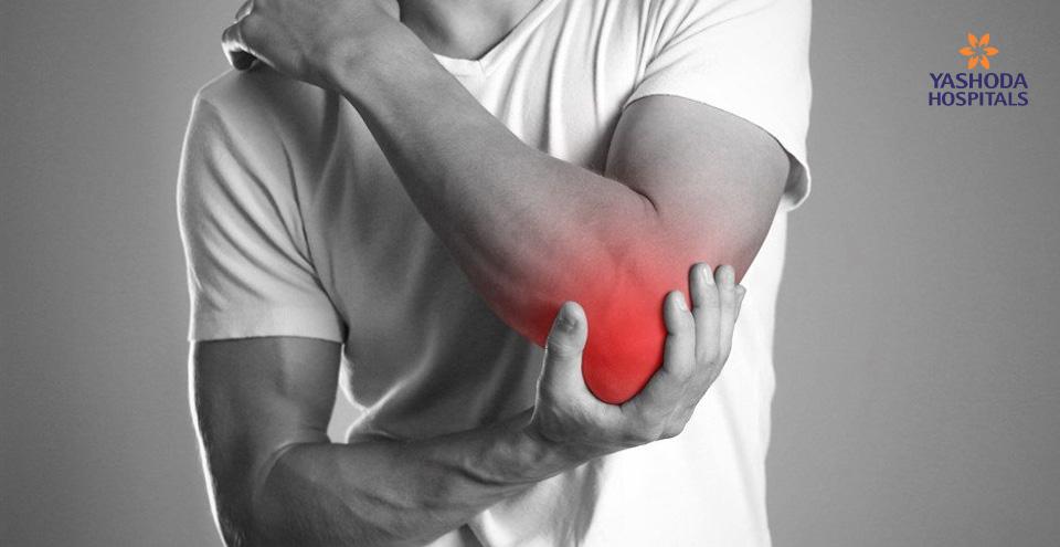 Tennis Elbow – Prompt diagnosis can have a huge impact on the prognosis