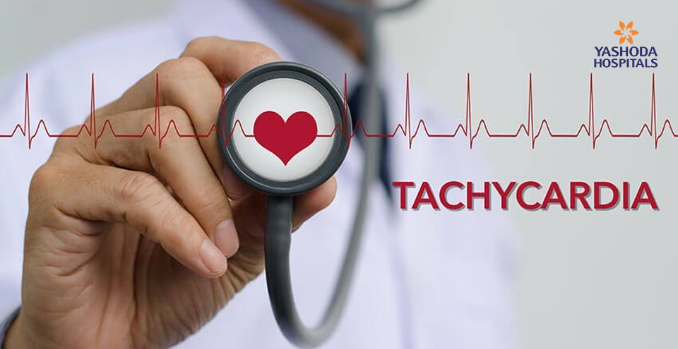 Arrhythmia, the common heart disease