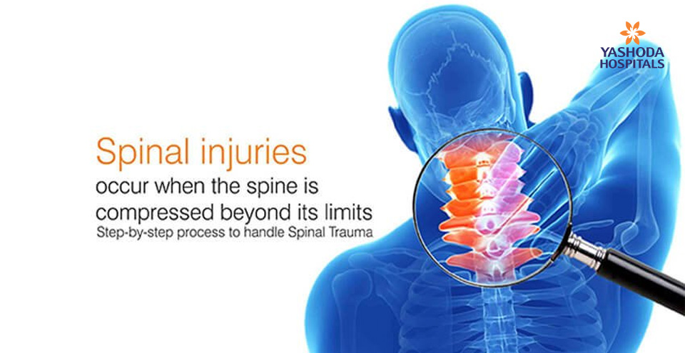 Step-by-step process to handle Spinal Trauma