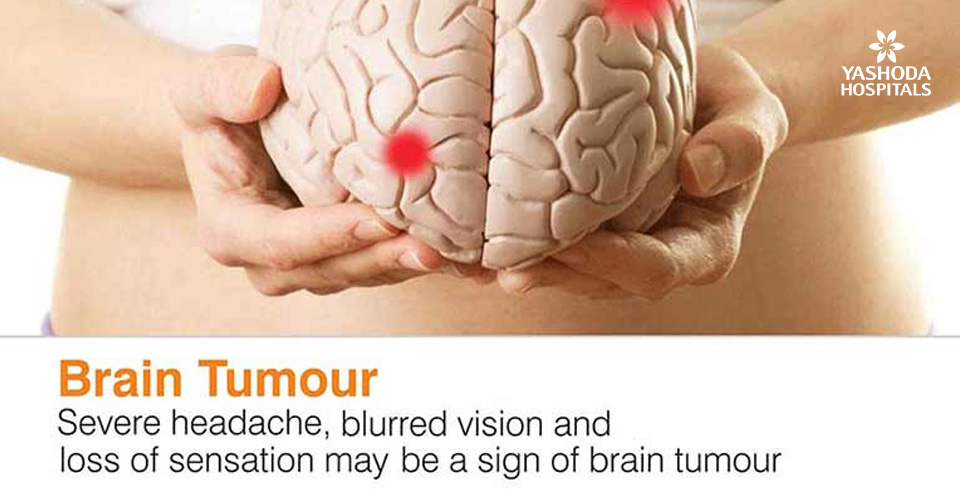 Brain Tumour Severe headache, blurred vision and loss of sensation may be a sign of brain tumour