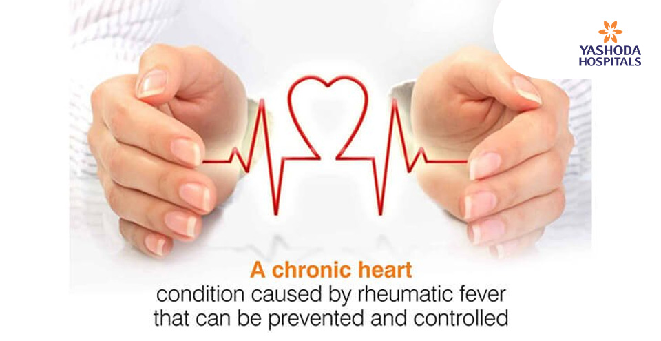 A chronic heart condition caused by rheumatic fever that can be prevented and controlled