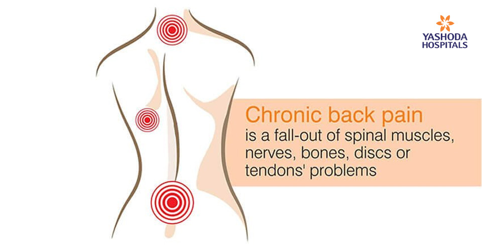 Chronic back pain is a fall-out of spinal muscles, nerves, bones, discs or tendons’ problems