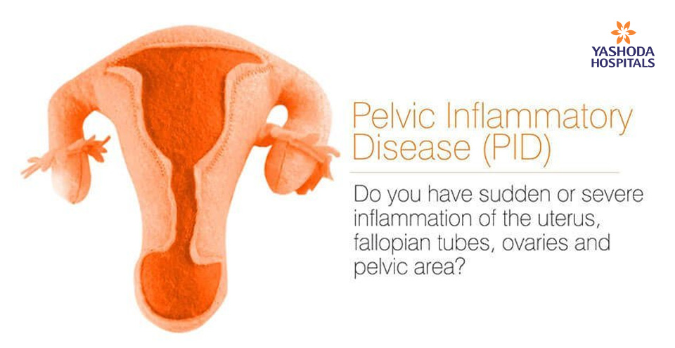 Pelvic Inflammatory Disease (PID)