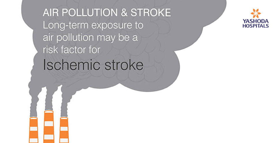 Air pollution and Stroke