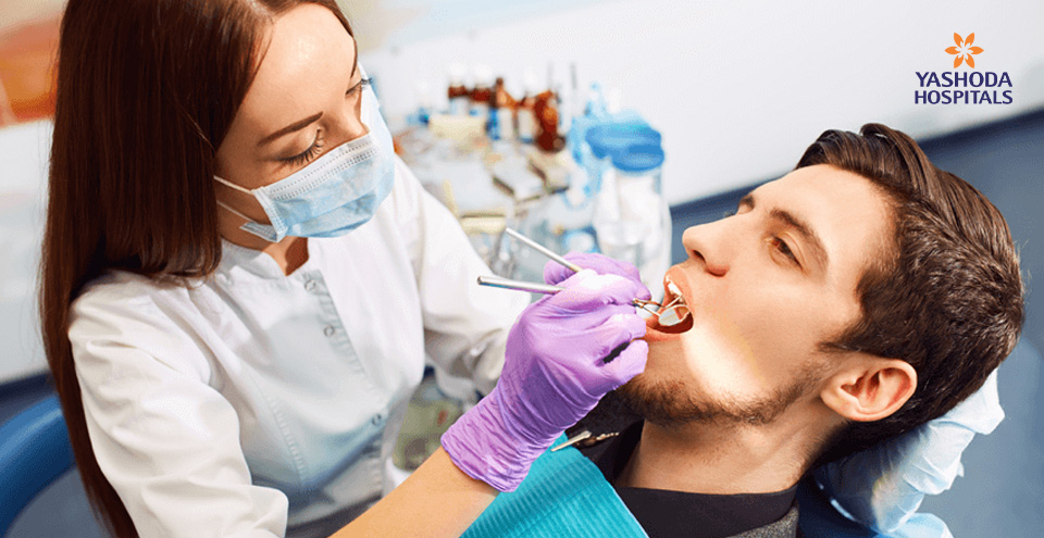 What is a Root Canal and do you need it?