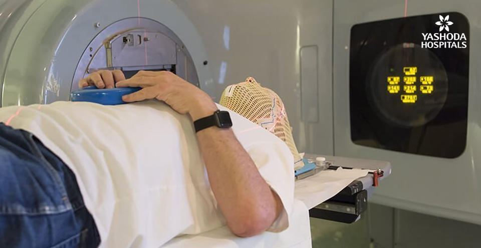 Advanced Radiosurgery to treat brain tumors without opening the skull