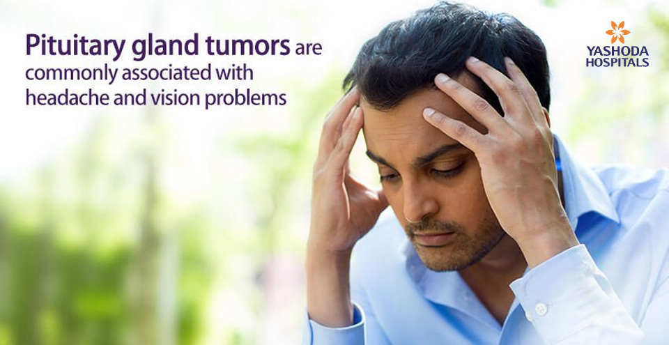 Pituitary Gland Tumors – Important Things To Know About