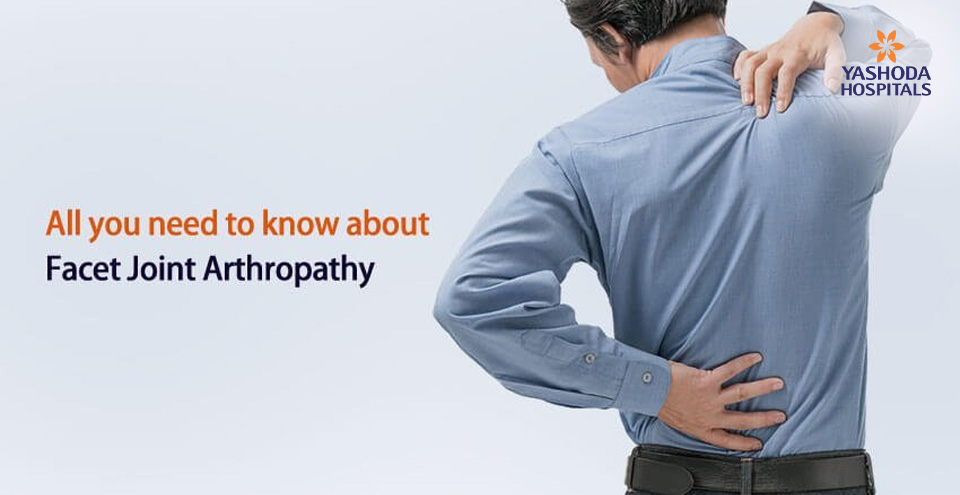 Facet Joint Arthropathy – What is it and how is it treated?