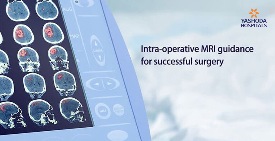 Brain surgery using intraoperative MRI: How does Intraoperative MRI help in neurosurgery?