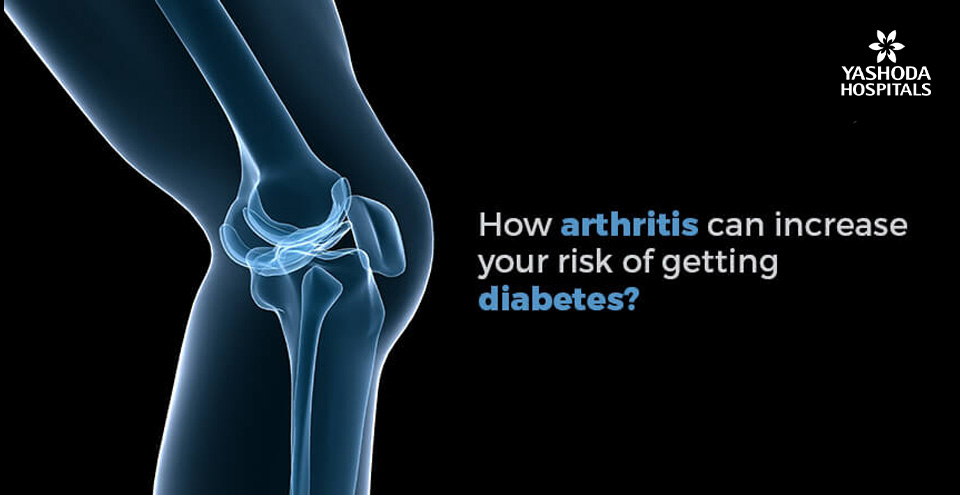 Arthritis and diabetes may go hand in hand