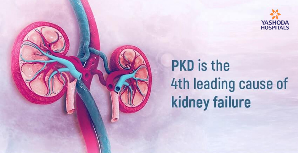 Learn the facts about PKD – Polycystic Kidney Disease