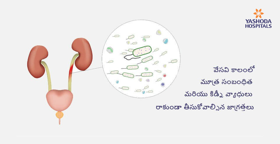 వేసవిలో వేధించే మూత్రనాళ, కిడ్నీ వ్యాధులు ముందు జాగ్రతతో ఉపశమనం, ప్రమాదకర సమస్యల నివారణ