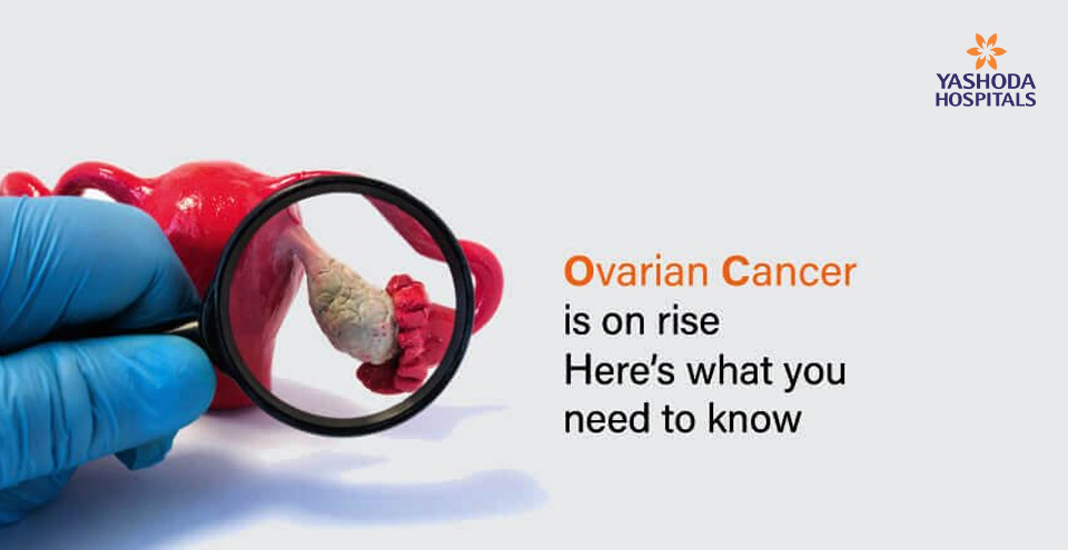 Does ovarian cancer affect your chances at pregnancy?