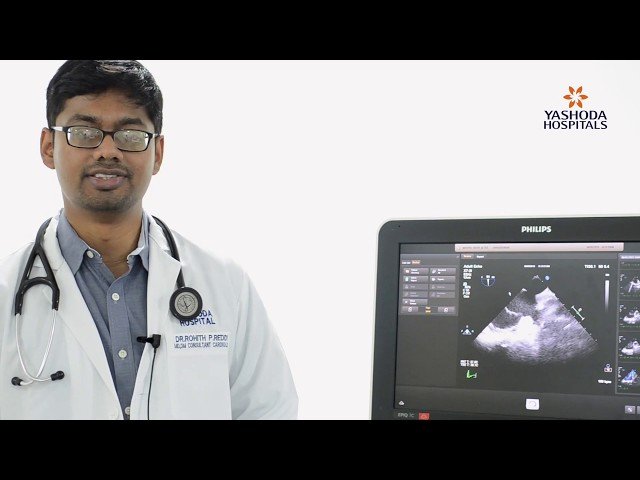 Hole in heart (Atrial Septal Defect)