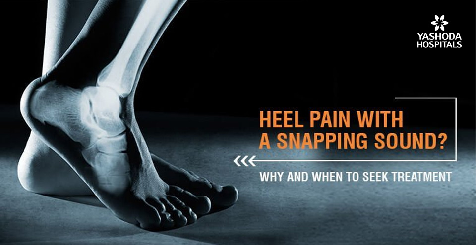 How to treat heel pain with a snapping sound?