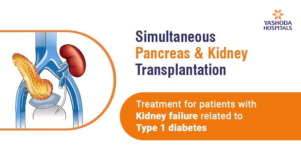 Simultaneous pancreas-kidney transplantation