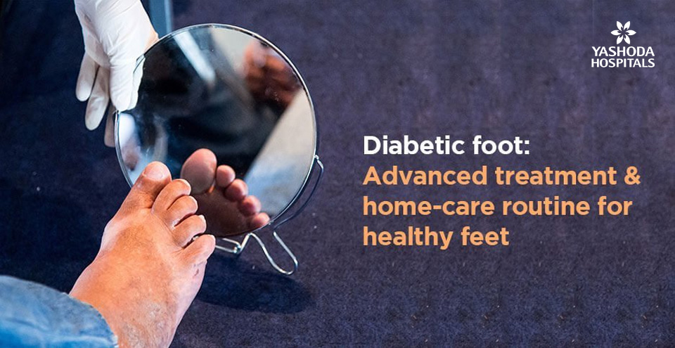 How to take care of diabetic foot at home? How to treat it using advanced methods?