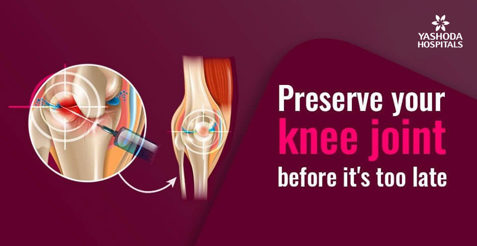 Knee joint preservation – Why and how its done?