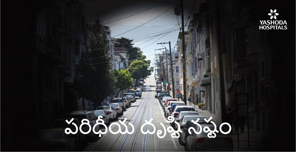 పరిధీయ దృష్టి నష్టం (peripheral vision loss) రోజువారీ జీవితాన్ని ఎలా ప్రభావితం చేస్తుంది?