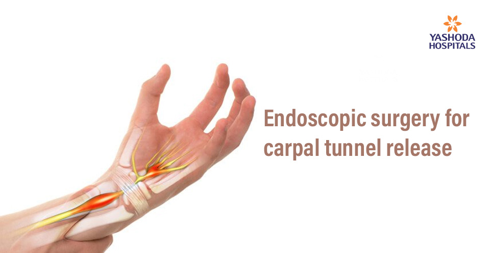 Endoscopic carpal tunnel release surgery