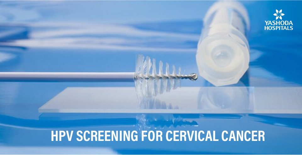 HR-HPV Screening for Cervical Cancer