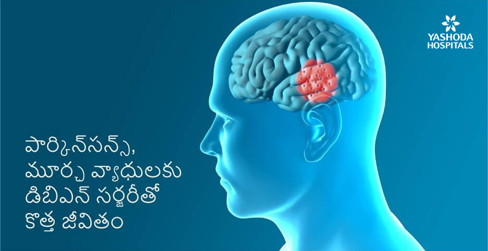 పార్కిన్‌సన్స్, మూర్ఛ వ్యాధులకు డిబిఎస్(DBS)  సర్జరీతో కొత్త జీవితం