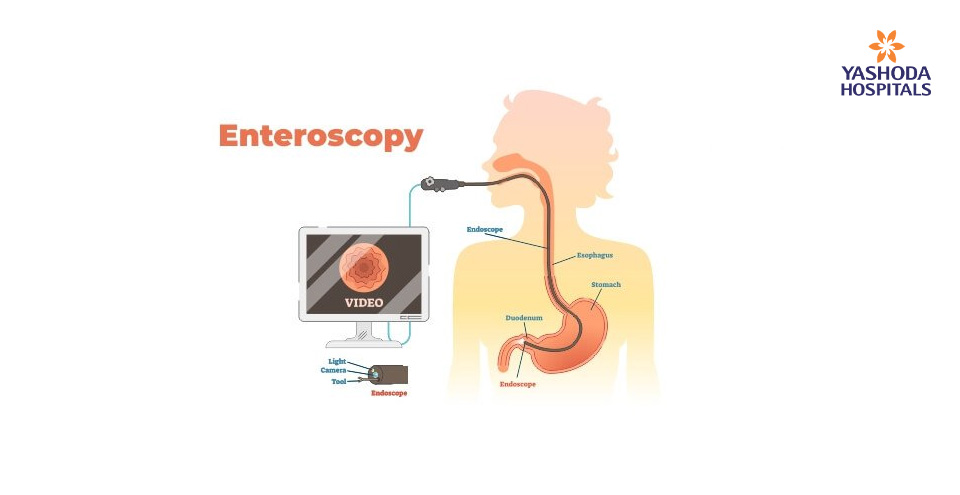 Enteroscopic techniques