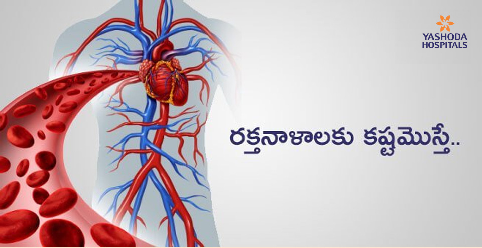 రక్తనాళాలకు కష్టమొస్తే..