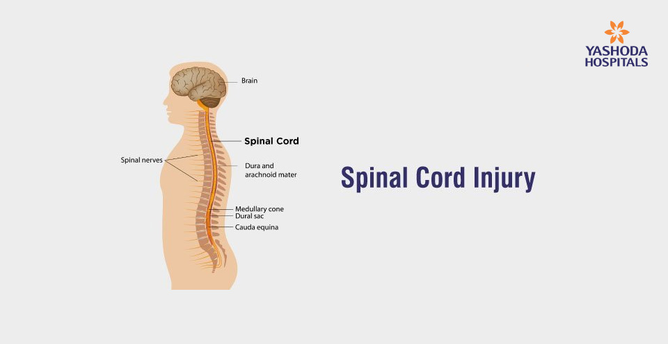 Spinal Cord Injury