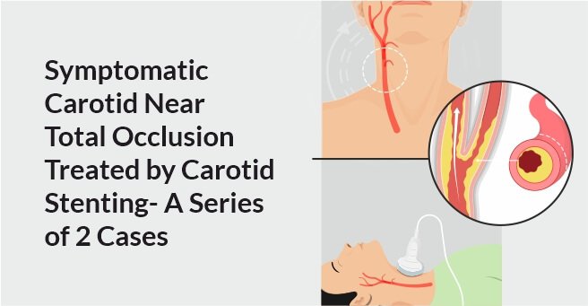 Symptomatic Carotid Near Total Occlusion Treated by Carotid Stenting