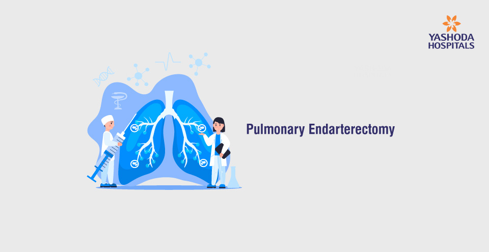 Pulmonary Endarterectomy: A Complex lifesaving lung surgery