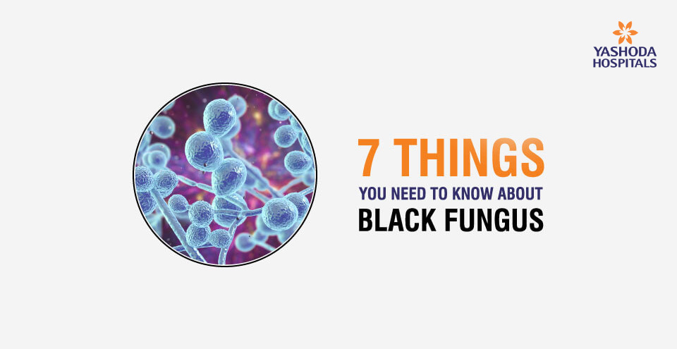 Expert’s take on 7 things you need to know about ‘Black fungus’