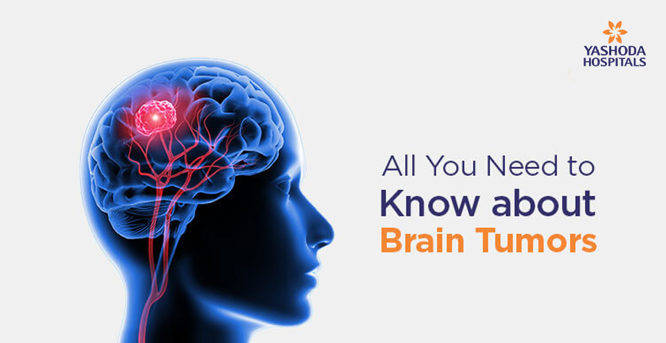 All You Need to Know about Brain Tumors