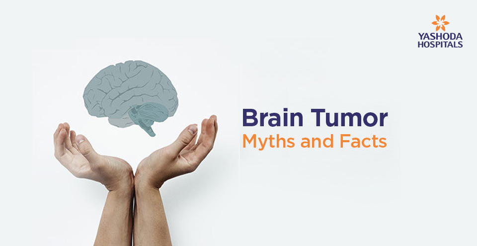 Brain Tumor Myths and Facts