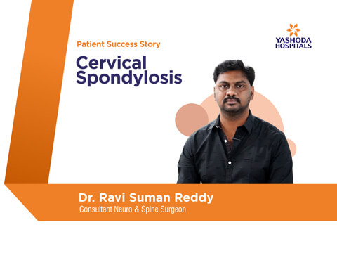 Cervical Spondylitis