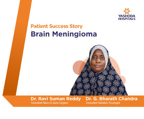 Brain Meningioma