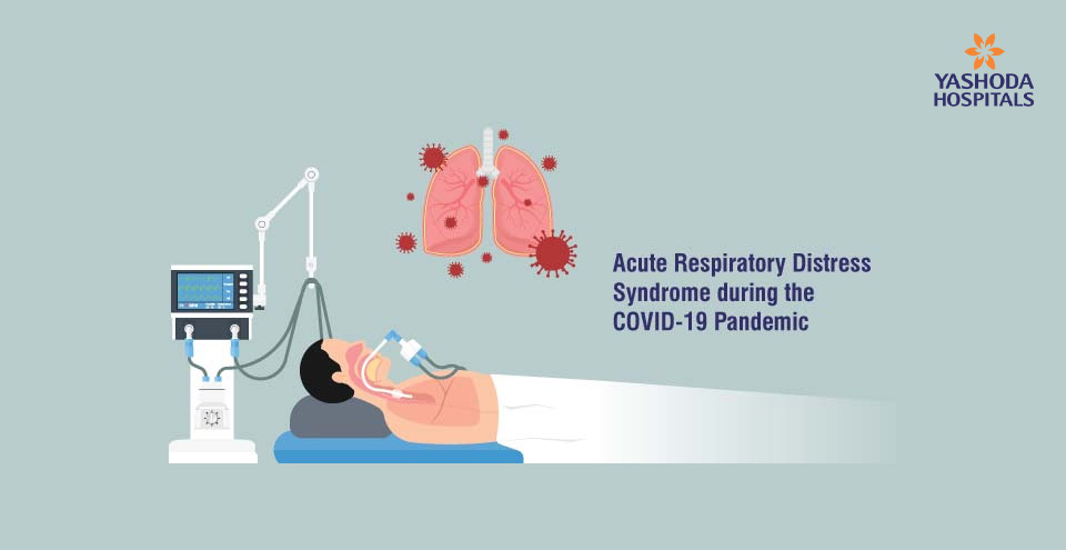 Acute Respiratory Distress Syndrome during the  COVID-19 Pandemic