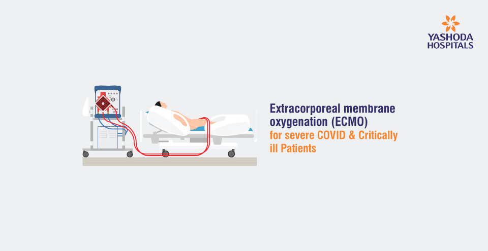 Extracorporeal membrane oxygenation (ECMO) for severe COVID & critically ill Patients