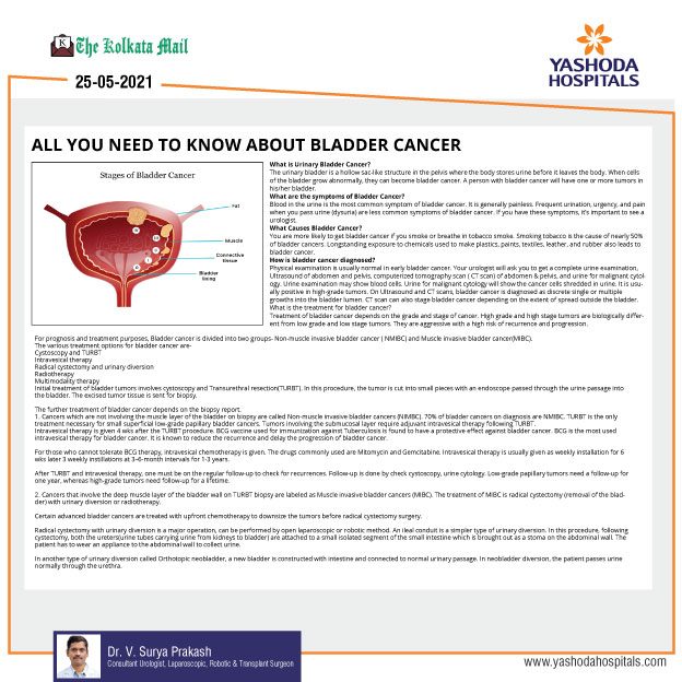 All you need to know about bladder Cancer