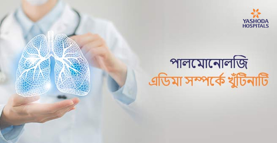 পালমোনোলজি এডিমা সম্পর্কে খুঁটিনাটি