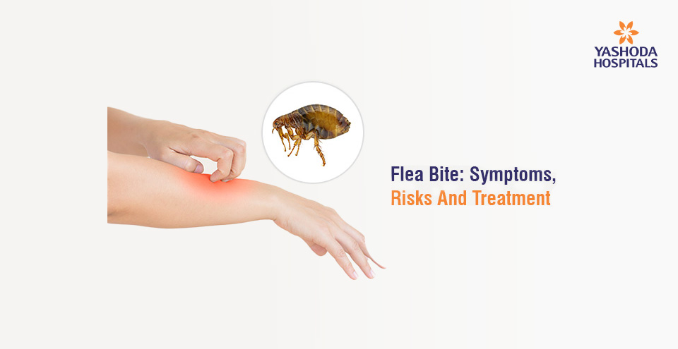 Flea Bite: Symptoms, Risks And Treatment