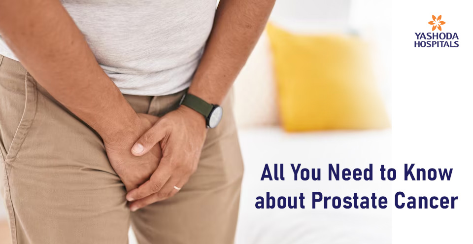 All You Need to Know about Prostate Cancer