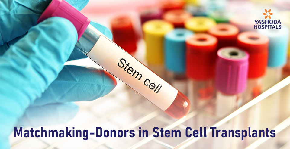 Matchmaking-Donors in Stem Cell Transplants