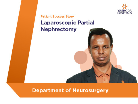 Laparoscopic Partial Nephrectomy