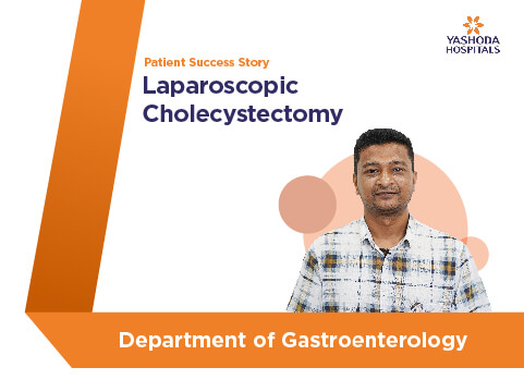 Laparoscopic Cholecystectomy