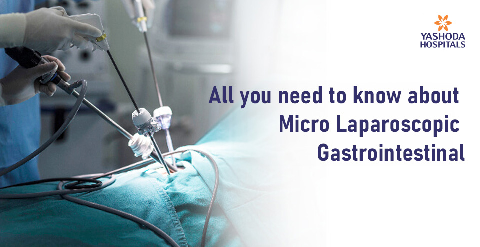 All you need to know about Micro Laparoscopic Gastrointestinal