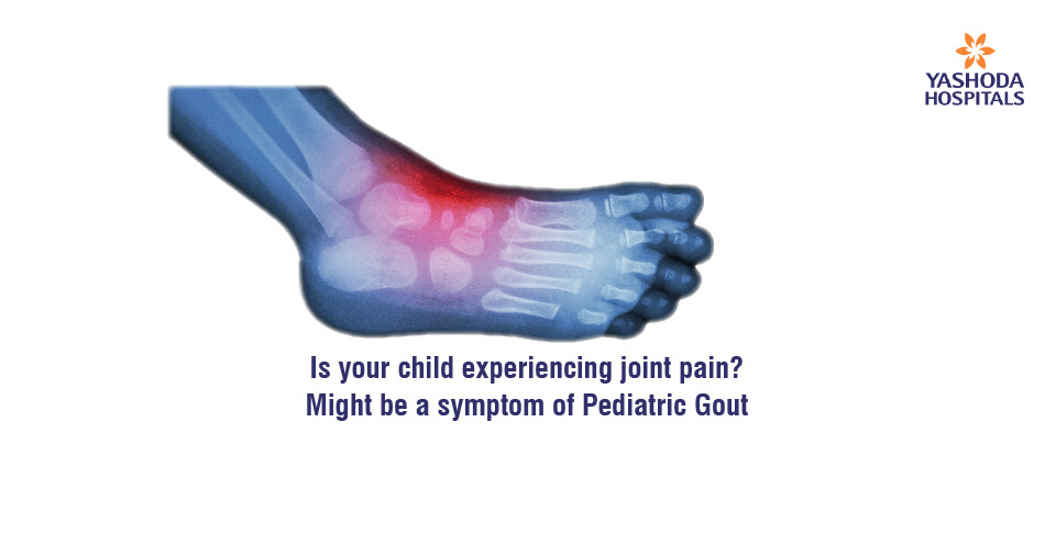 Is your child experiencing joint pain? Might be a symptom of Pediatric Gout