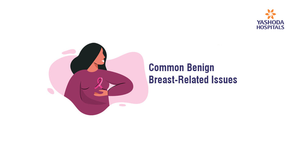 Common Benign Breast Related Issues