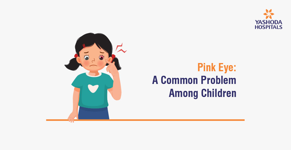 Pink Eye: A Common Problem Among Children